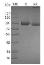 Recombinant Mouse Myeloperoxidase/MPO (C-10His)