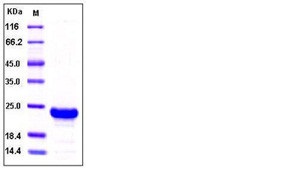Recombinant Human Retinol-Binding Protein 4/RBP4 (C-His) Recombinant Human Retinol-Binding Protein 4/RBP4 (C-His)