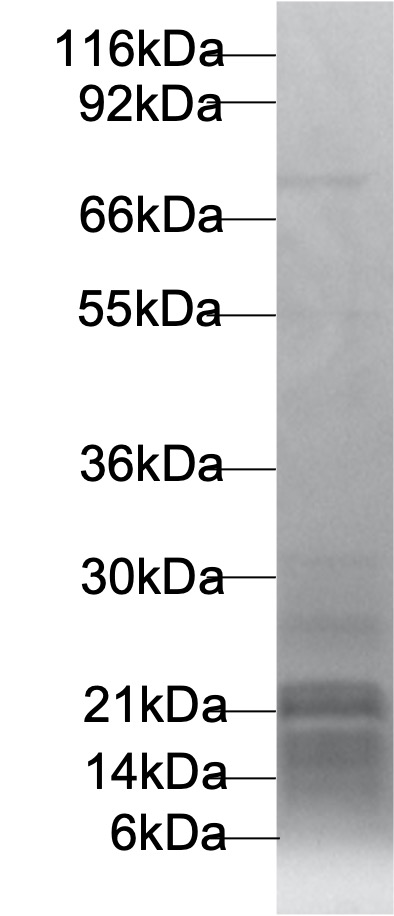 Recombinant Human Lacritin/LACRT (N-6His)