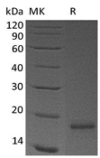 Recombinant Human CLDN18.2/Claudin-18 A2 (N-8His)