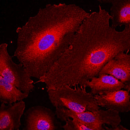 Monoclonal Antibody to 14-3-3 Eta (14-3-3 Eta)(Clone: 3G12)