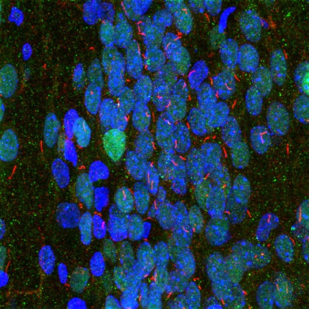 Polyclonal Antibody to Adenylate Cyclase III(Discontinued)