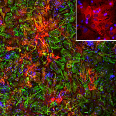 Polyclonal Antibody to Aldehyde dehydrogenase H1L1, ALDH1L1