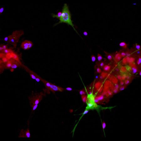 Monoclonal Antibody to Aldolase C: C terminal (Clone: 1A1)