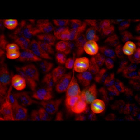 Monoclonal Antibody to Aurora A Kinase  (Clone: 1A11)