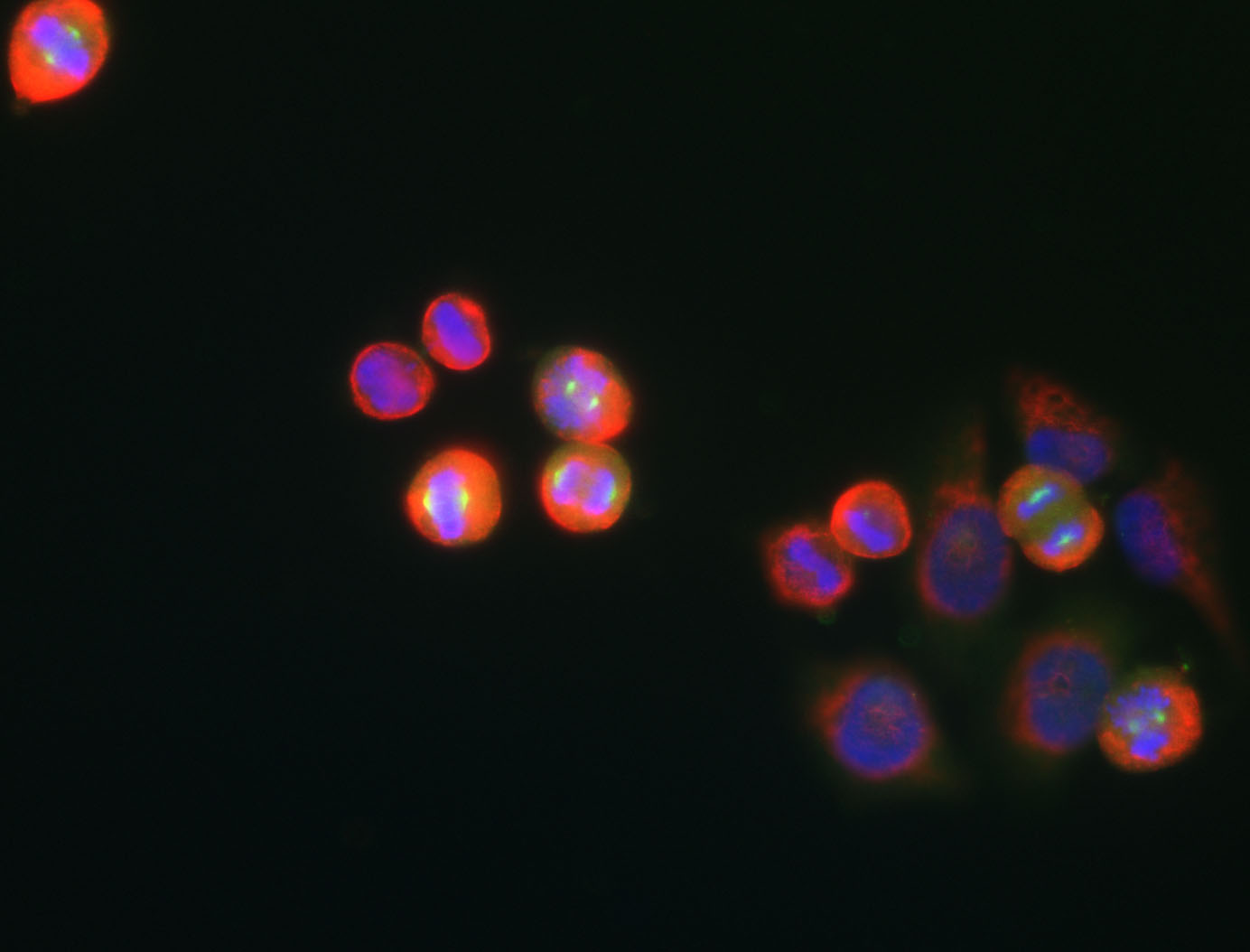 Monoclonal Antibody to Aurora A Kinase  (Clone: 1A14)(Discontinued)