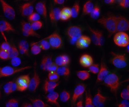 Monoclonal Antibody to Aurora A/B Kinase  (Clone: 3H1)