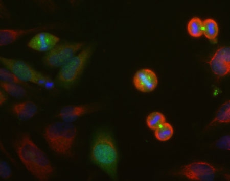 Monoclonal Antibody to Aurora A Kinase  (Clone: 4A7)