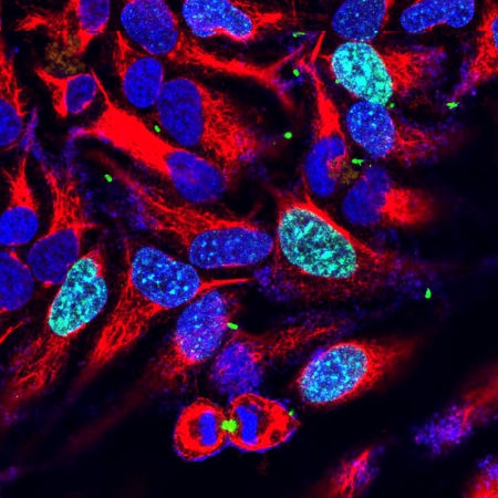 Monoclonal Antibody to Aurora B Kinase  (Clone: 3F11)