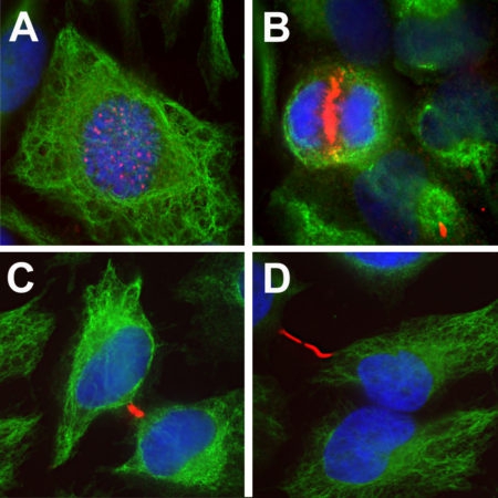 Monoclonal Antibody to Aurora B Kinase  (Clone: 6G2)