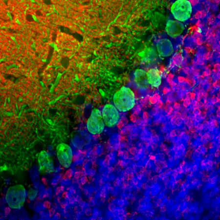 Monoclonal Antibody to Calbindin(Clone: 4H7)