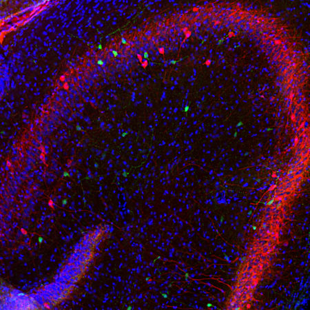 Polyclonal Antibody to Calretinin