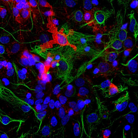 Polyclonal Antibody to Coronin 1a