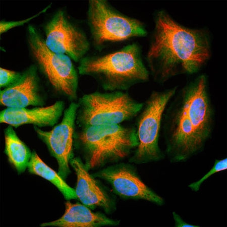 Monoclonal Antibody to DJ1  (Clone: 4H4)