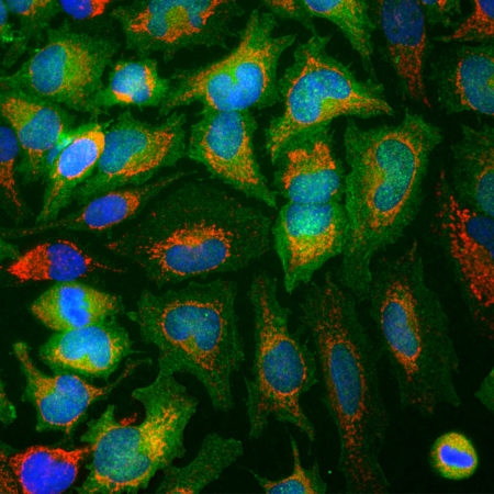 Monoclonal Antibody to Enolase-Alpha/ non-neuronal enolase (Clone: 253)