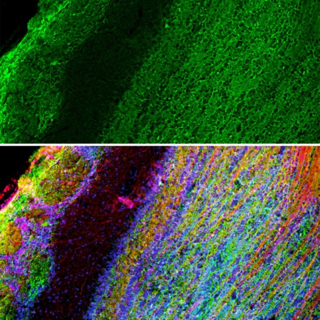 Monoclonal Antibody to GAP43  (Clone: 1E3) (Discontinued)