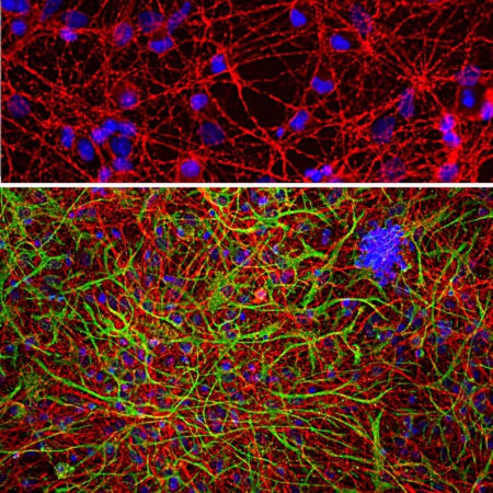 Monoclonal Antibody to GAP43  (Clone: 5E8)