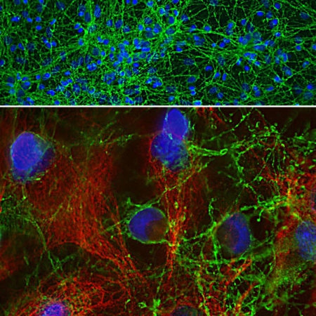 Polyclonal Antibody to GAP43