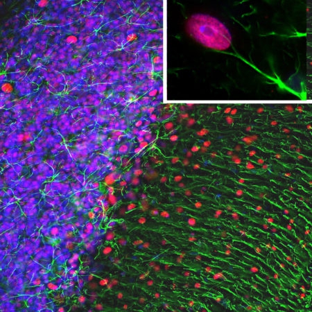 Polyclonal Antibody to Glial Fibrillary Acidic Protein,GFAP