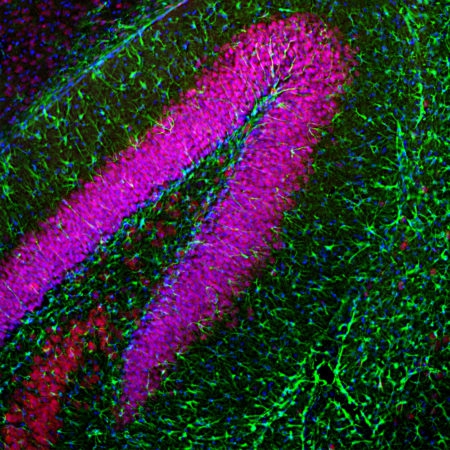 Polyclonal Antibody to Glial Fibrillary Acidic Protein, GFAP