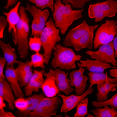 Polyclonal Antibody to Glyceraldehyde 3-Phosphate Dehydrogenase