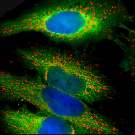 Polyclonal Antibody to Heat shock protein 27, HSP27