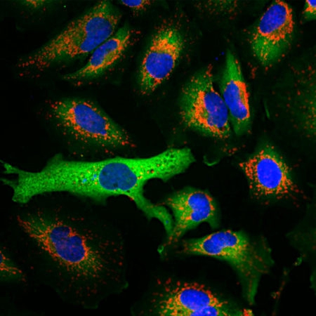 Monoclonal Antibody to Heat shock protein 27, HSP27(Clone: 6H11)