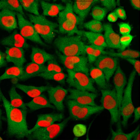 Monoclonal Antibody to High mobility group box 1, Amphoterin, HMGB1(Clone: 1F3)