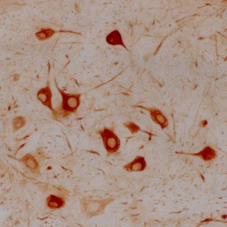 Monoclonal Antibody to a-internexin/NF66  (Clone: 2E3)