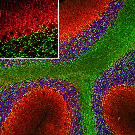 Polyclonal Antibody to a-internexin/NF66