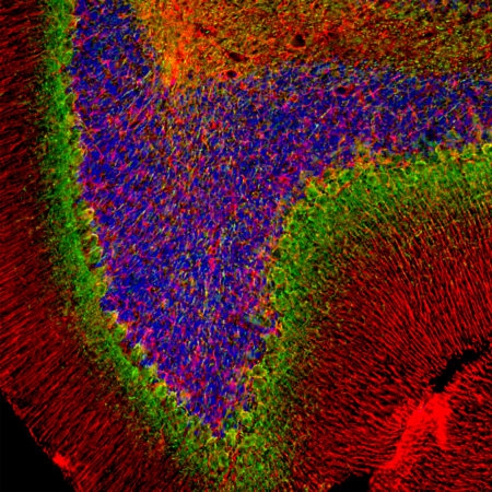 Polyclonal Antibody to a-internexin/NF66