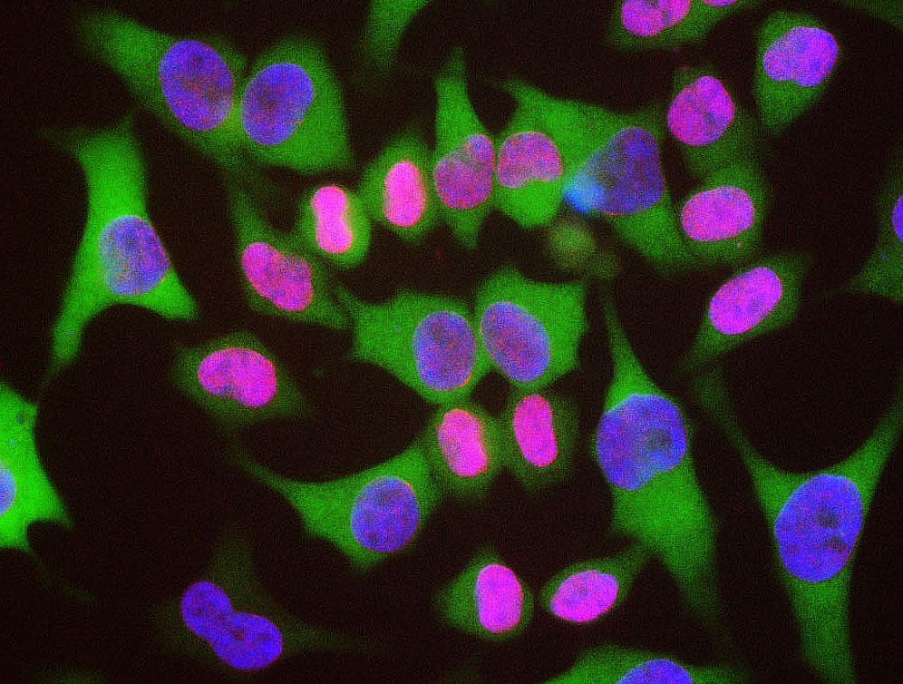 Polyclonal Antibody to Lamin A/C  (Discontinued)