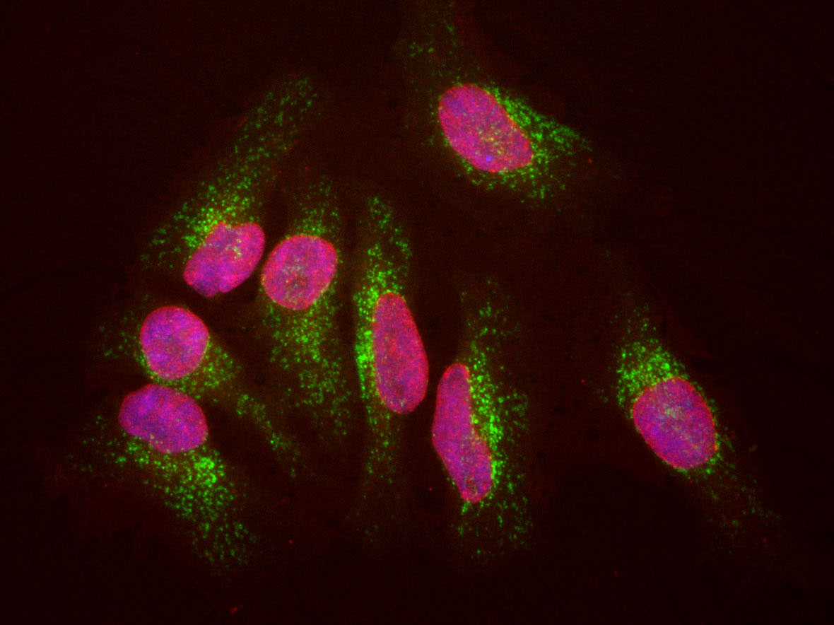 Monoclonal Antibody to Lamp1 (Clone: 6E2)(Discontinued)