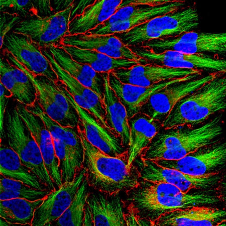 Polyclonal Antibody to MARCKS