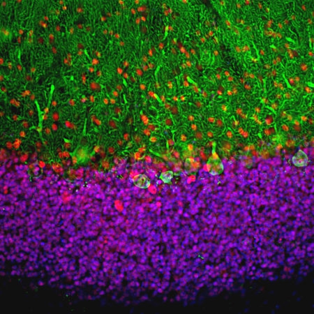 Polyclonal Antibody to MECP2