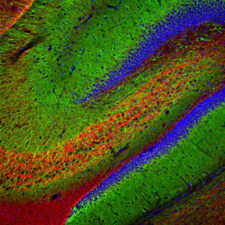 Monoclonal Antibody to  Microtubule Associated Protein 2, MAP2A/B (Clone: 5H11)