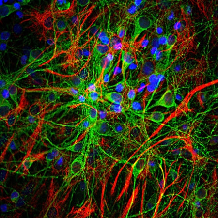 Monoclonal Antibody to Microtubule Associated Protein t, MAPT(Clone: 5B10)