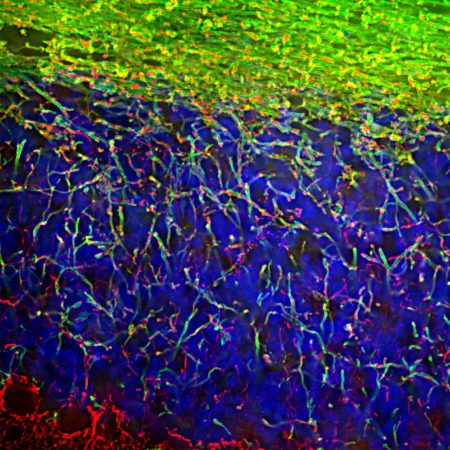 Polyclonal Antibody to Myelin Basic Protein, MBP