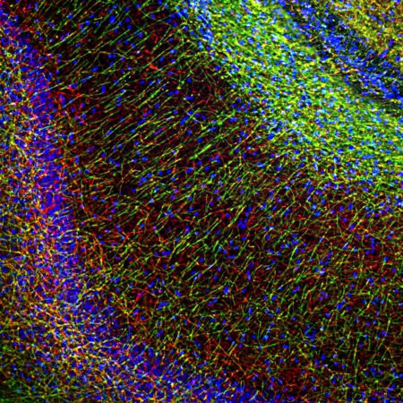 Monoclonal Antibody to Myelin Basic Protein, MBP(Clone: 7G7)