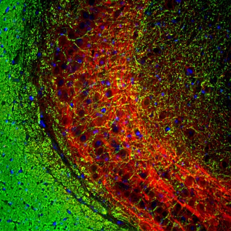 Monoclonal Antibody to Myelin Basic Protein, MBP(Clone: 7D2)