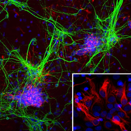 Monoclonal Antibody to Nestin(Clone: 4D11)