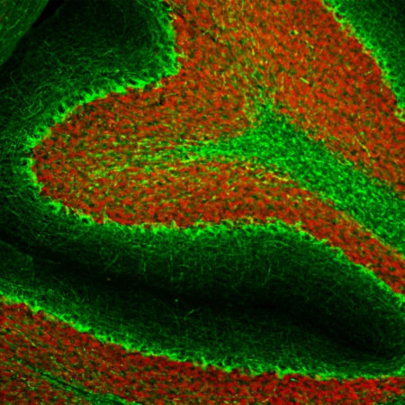 Monoclonal Antibody to Neurofilament NF-H  (Clone: AH1)