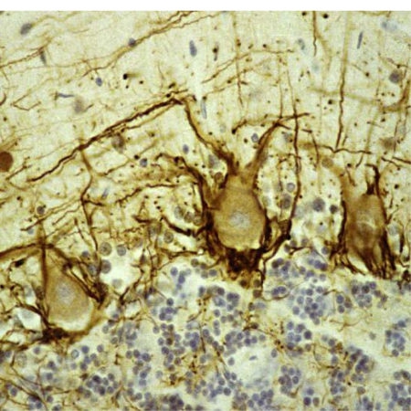 Monoclonal Antibody to Neurofilament NF-H  (Clone: NAP4)