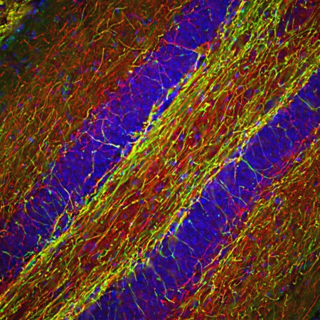 Polyclonal Antibody to Neurofilament NF-H