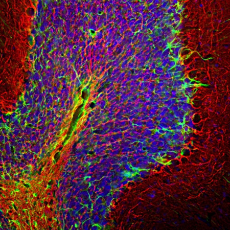 Polyclonal Antibody to Neurofilament NF-H