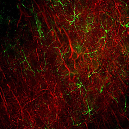 Monoclonal Antibody to Neurofilament NF-L  (Clone: DA2)