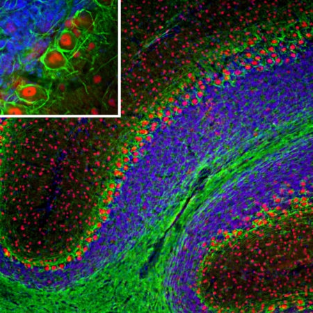 Monoclonal Antibody to Neurofilament NF-L  (Clone: 7D1)