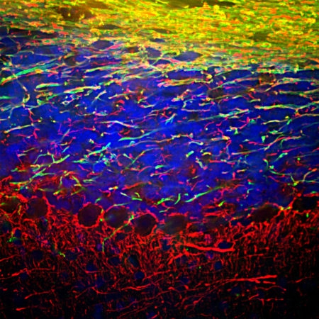 Polyclonal Antibody to Neurofilament NF-L