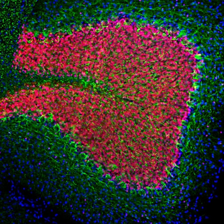 Polyclonal Antibody to Neurofilament NF-L