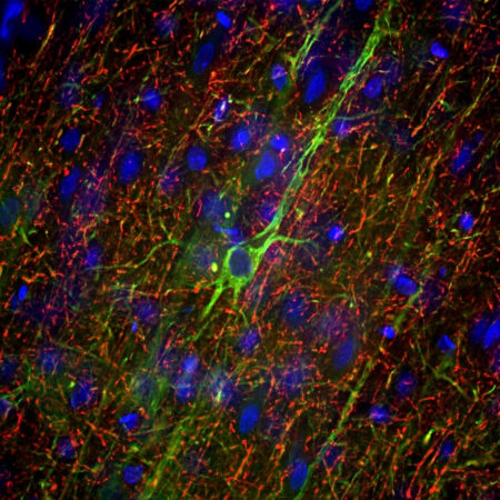 Monoclonal Antibody to Neurofilament NF-M  (Clone: 3H11)